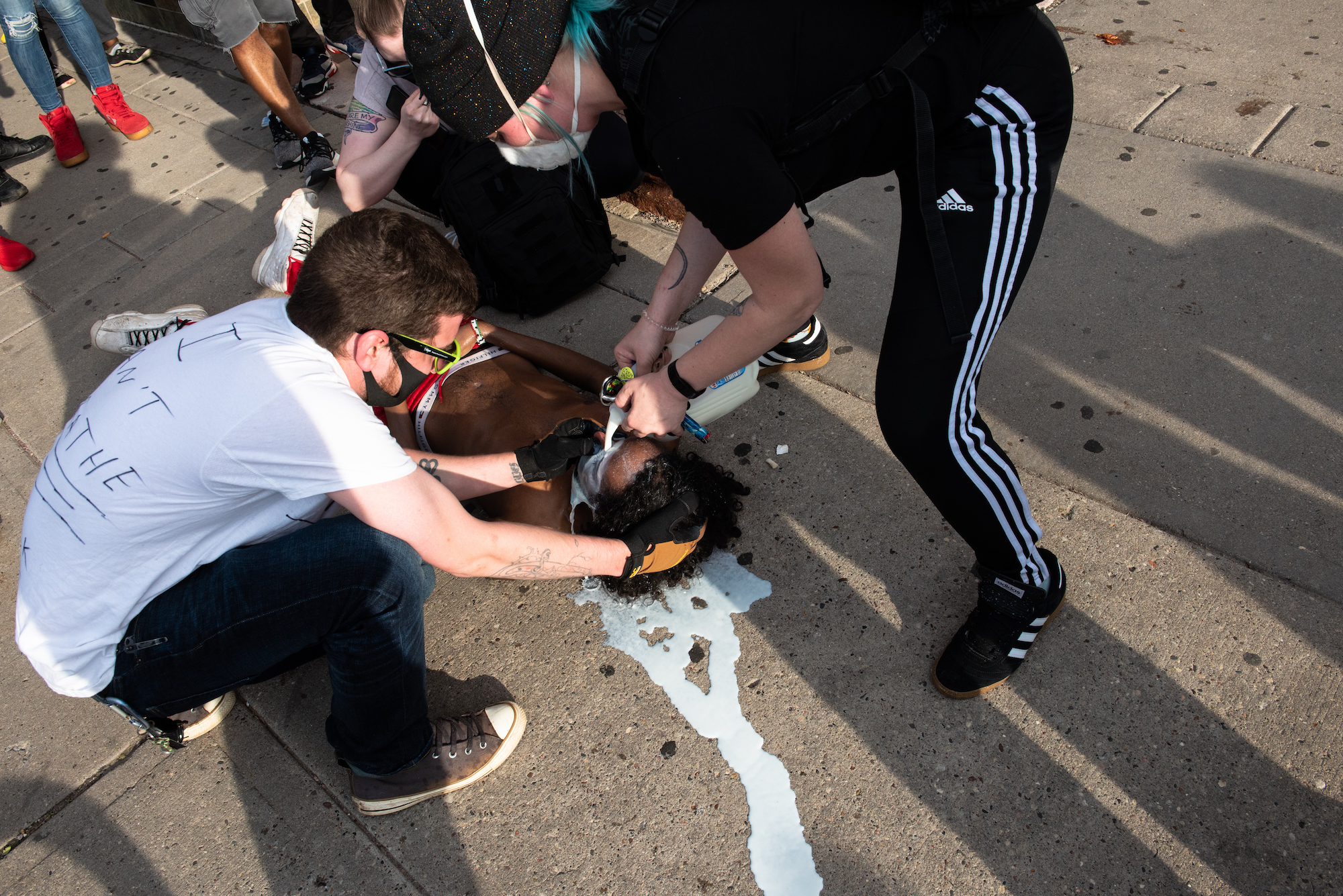 Pouring milk into the eyes of a protestor who is laying down